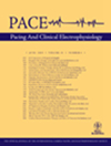 Pace-pacing And Clinical Electrophysiology杂志